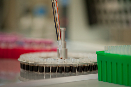 Whole blood specimens are loaded into vials to test for lead exposure in children.